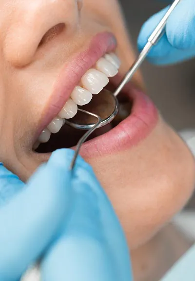 closeup of patient getting a dental checkup