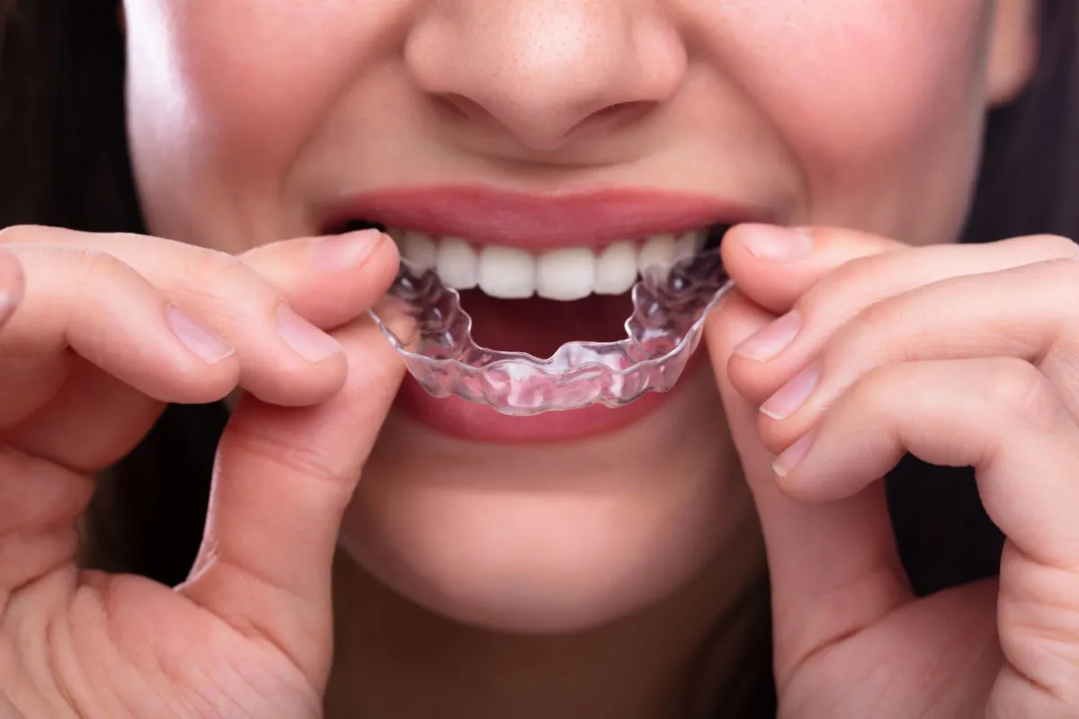 woman putting in her Invisalign clear aligners